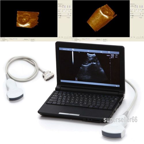 High Resolution Digital Laptop Notebook Ultrasound Scanner Convex Probe Free 3D-
