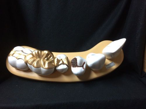 Denoyer Geppert A84 Dental Morphology Anatomical Teeth Model 7-Part Series -A 84