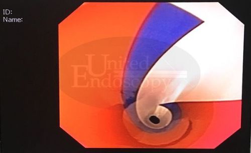 OLYMPUS  TJF-130 ERCP Video Jumbo Channel Duodenoscope Endoscope, Endoscopy