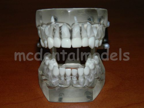 NEW PEDIATRIC TYPODONT DENTAL MODEL TEETH REMOVABLE CLEAR ACRYLIC  STUDY