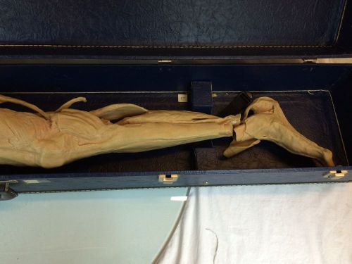 Vintage Nasco Lifeform Anatomical Leg with case.  Foot is almost severed