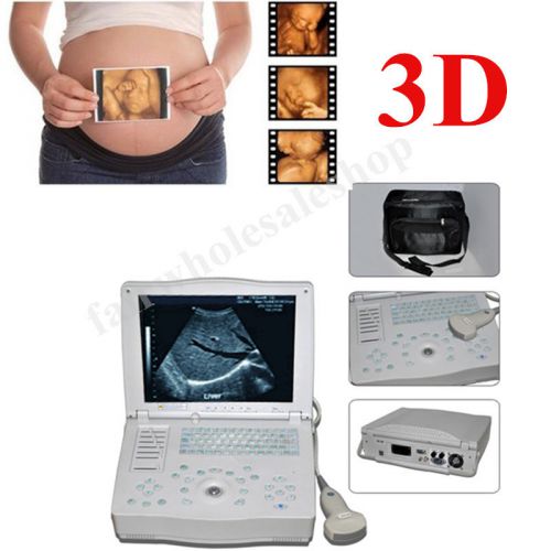 NEW 15-inch LCD Digital Laptop Ultrasound Scanner + convex probe 3D workstation