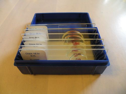 Chick Embryo Microscope Slides - 6 Slides; 18, 24, 33, 48, 96-hr plus composite