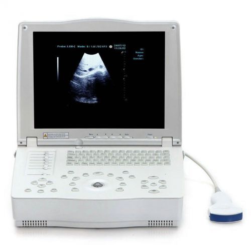 FULL DIGITAL LAPTOP ULTRASOUND SCANNER MACHINE + CONVEX PROBE CE 100% WARRANTY