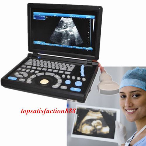 3D PC Notebook Digital Laptop Ultrasound Scanner With 3.5Mhz abdominal Probe