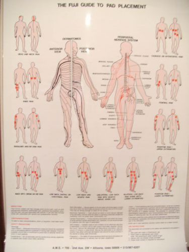 The Fuji Guide To Pad Placement - Laminated 17&#034; x 24&#034;