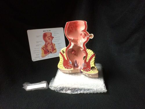 GPI #3350 - Human Rectum Anatomical Model with Pathologies