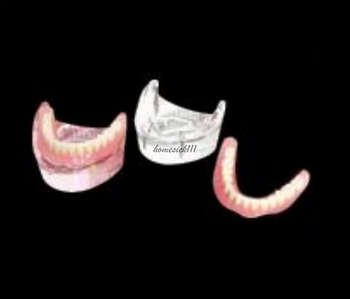 XINGXING Overtenture Inferior With 2 Implants Restoration Tooth Model 6002  HO