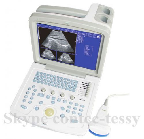 CE Portable Ultrasound Scanner 12.1inch CMS600B-3+3.5Mhz convex probe