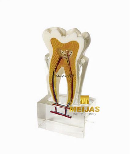 XINGXING Six Times The Normal Tooth Anatomy Model For Dental Teaching 4019  HO