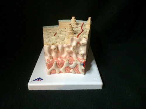 3B Scientific - A79 MICROanatomy Bone structure Anatomical Model (A 79)