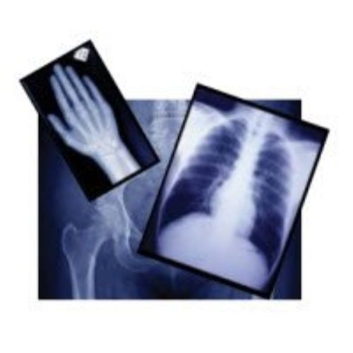 UMG DENTAL 6&#034; X 12&#034; X-RAY DUPLICATING FILM - BOX OF 100 SHEETS