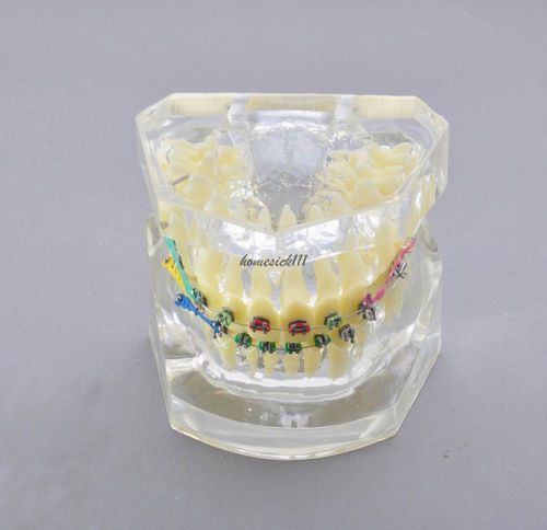 XINGXING Orthodontic Treatment Study Model With Bracket and Arch Wire 3005-II  H