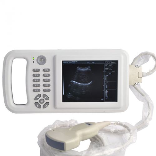 Handheld Full Digital Laptop Ultrasound Scanner with Convex Probe