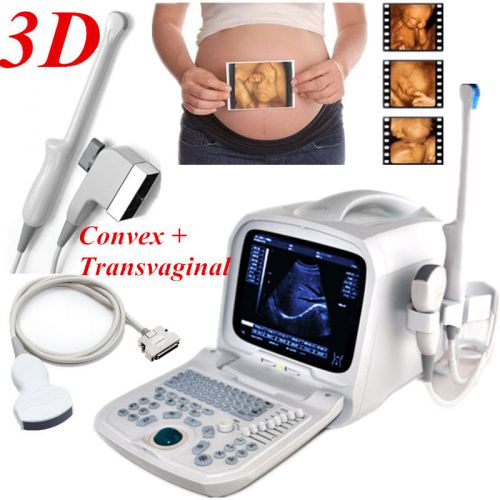 Internal 3D 3.5mhz convex+6.5mh Transvaginal Portable Ultrasound Scanner machine