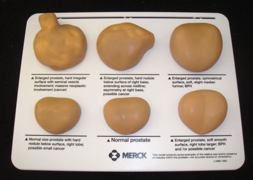 Prostate Anatomical Model for Patient Education in box