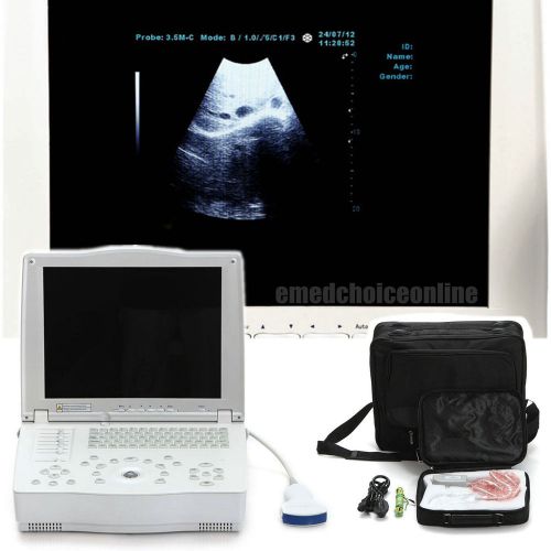 FDA Full Digital Laptop 15-inch Ultrasound Scanner +Convex Probe + Free 3D CE