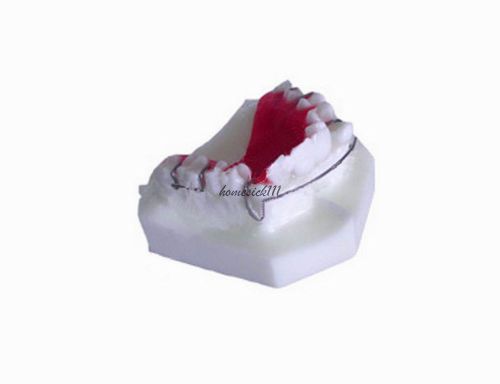 XINGXING Dental Teach Study Orthodontic Treatment Retainer Model 3007  HO